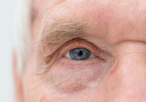 Retinal Health and Aging: What to Expect as You Grow Older